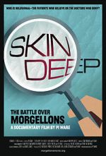 Watch Skin Deep: The Battle Over Morgellons 9Movies
