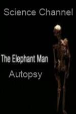 Watch Science Channel Elephant Man Autopsy 9Movies