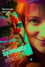 Watch Skinned 9Movies