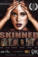 Watch Skinned 9Movies