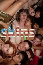 Watch Skins (US) 9Movies